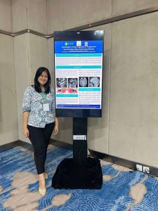 Partisipasi Residen Neurologi Universitas Udayana dalam Lomba Poster ASNA 2025 2
